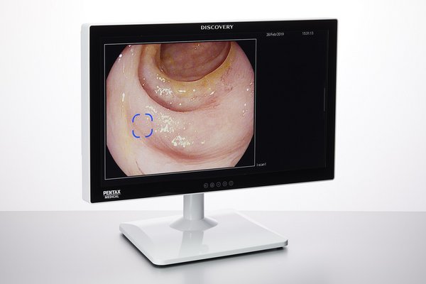 DISCOVERY(TM), an AI Assisted Polyp Detector