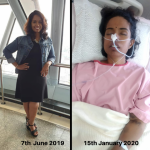 Passionate teacher seeks public help as she suffers from a rare disease