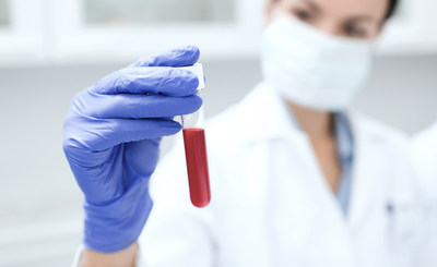 Simple blood test makes cancer detection possible at an early stage Simple blood test makes cancer detection possible at an early stage