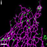 Cambridge Infinitus Research Centre Made New Research Progress