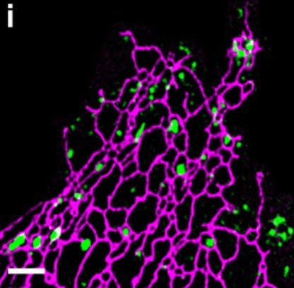 Ultra-high resolution image of the endoplasmic reticulum (purple) and lysosome (green), which is from the content of the paper published in Science Advances Ultra-high resolution image of the endoplasmic reticulum (purple) and lysosome (green), which is from the content of the paper published in Science Advances