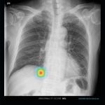 Lunit Announces Partnership to Incorporate its Chest Detection Suite into Philips’ Diagnostic X-ray Suite