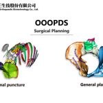 OOOPDS – a surgical planning software received TFDA Class-II medical device certification developed by Taiwan Main Orthopaedic Biotechnology Co., Ltd.