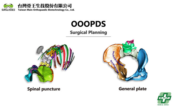 OOOPDS medical used surgical planning software received TFDA Class II OOOPDS medical used surgical planning software received TFDA Class II