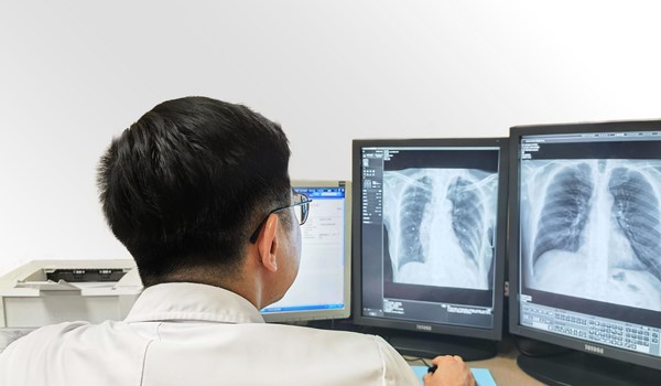 A doctor reading CXR scans using SenseCare-Chest DR Pro diagnostic software A doctor reading CXR scans using SenseCare-Chest DR Pro diagnostic software
