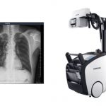 VUNO Inks Deal with Samsung Electronics to Embed AI-powered Algorithms in Samsung’s Premium Mobile X-ray System