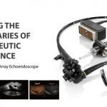 SonoScape obtains CE Mark for its linear array echoendoscope EG-UC5T