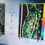 Taiwan’s medical device company challenges the limit of science, launching the most expensive collagen in the contemporary market