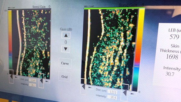 Taiwan’s medical device company challenges the limit of science, launching the most expensive collagen in the contemporary market.