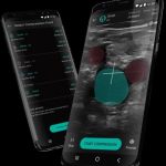 ThinkSono DVT detection software results are published in Nature digital medicine (npj)