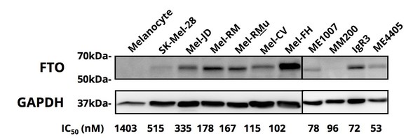 Figure 2. FTO protein expression determined by western blot. Figure 2. FTO protein expression determined by western blot.