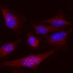 Zantrene® kills melanoma cancer cells that overproduce FTO