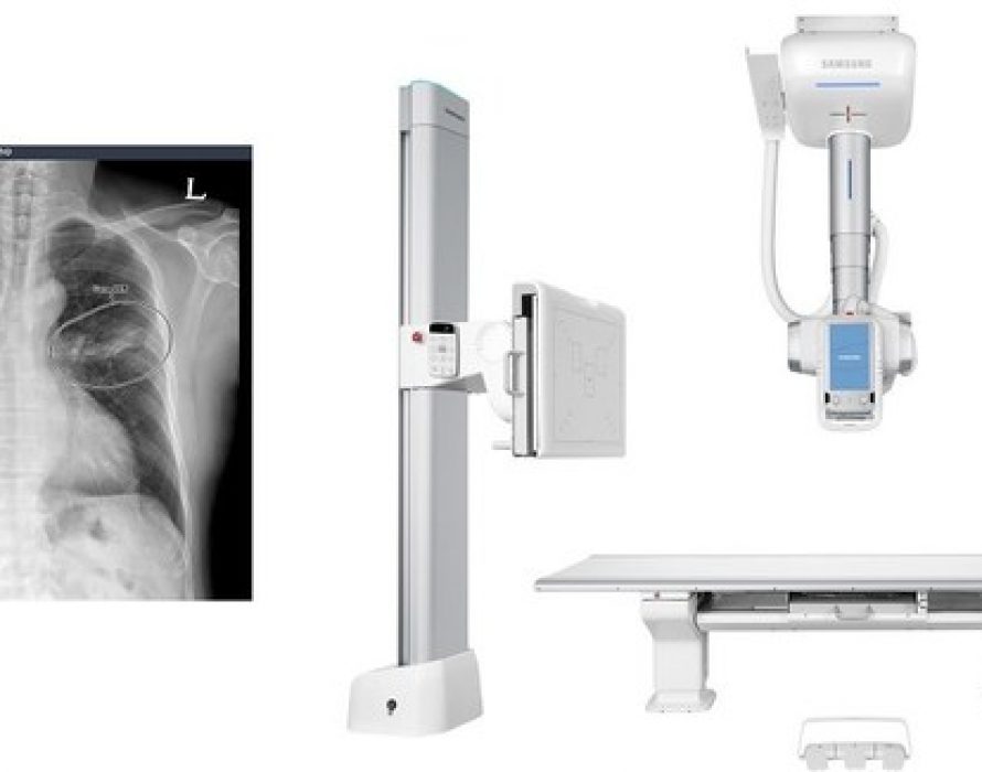 VUNO Signs Another Deal with Samsung Electronics to Incorporate AI-assisted Solutions into Samsung’s Premium Ceiling Type Digital Radiography System