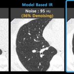 ClariPi to Showcase its AI Medical Imaging Solutions at RSNA 2021