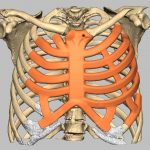 Incredible World First Ribcage Implant Becomes ‘alive’
