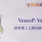 Venus Medtech appoints Shakeel Osman as Senior VP of Sales Europe to drive commercialization of TPVR system