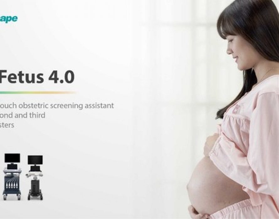 SonoScape S-Fetus 4.0 Release to Simplify Sonography Process