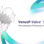 VenusP-Valve(TM) obtains CE marking under MDR and debuts in Europe as China’s first valve product