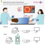 DeepGI AI – A Thai Innovation for the Precision in Colorectal Polyp Detection