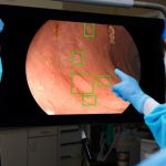 Farrer Park Hospital Taps on AI to Improve Colorectal Cancer Screening Results