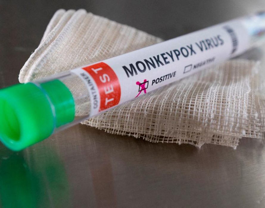 Russia confirms first monkeypox case: Consumer rights watchdog