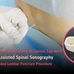 Increased Precision and Safety in Spinal Tap with PASS – An Ultrasound-Guided Lumbar Puncture Procedure