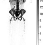 UC Davis’ new research shows how total-body PET imaging can assess the immunological response to COVID-19 infections