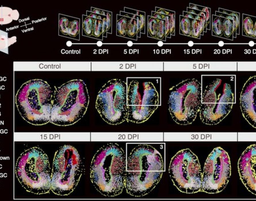 BGI-led Research Builds the World’s First Spatiotemporal Map of Brain Regeneration