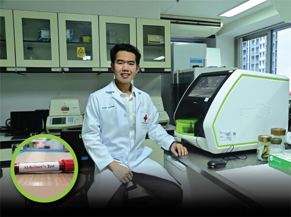 Chula Medicine Reveals Detection of Latent Dementia