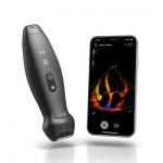 Mindray Revolutionizes the Way of Using Ultrasound with TE Air, Its First Wireless Handheld Ultrasound System