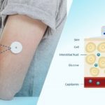 NOVOSENSE NST1002 facilitates accurate CGM measurement with glucose monitoring black technology