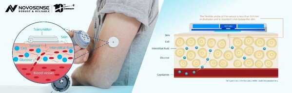 Structure design and installation position of temperature sensor NST1002 applied in CGM Structure design and installation position of temperature sensor NST1002 applied in CGM
