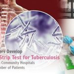 Chula Researchers Develop Rapid MTB Strip Test for Tuberculosis