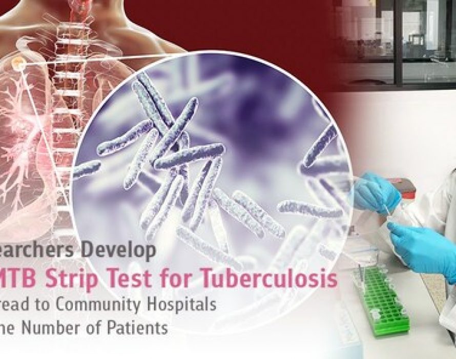 Chula Researchers Develop Rapid MTB Strip Test for Tuberculosis