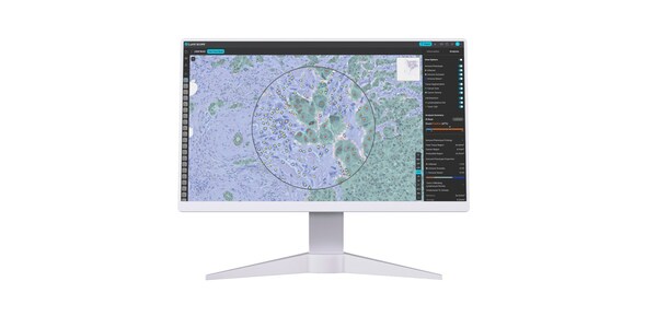 Lunit's AI-biomarker platform, Lunit SCOPE IO