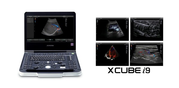 ALPINION Launches a High-Performance Portable Ultrasound Diagnostic Device, X-CUBE i9 ALPINION Launches a High-Performance Portable Ultrasound Diagnostic Device, X-CUBE i9
