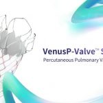 VenusP-Valve granted IDE approval for clinical trial, unveiling a new chapter for Chinese valve solutions globally