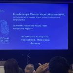 Broncus Announced Long-Term Follow-Up Data on InterVapor, Showing Stable Long-Term Efficacy in Patients