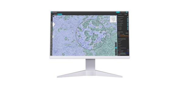 Lunit's AI-powered TIL analyzer, Lunit SCOPE IO Lunit's AI-powered TIL analyzer, Lunit SCOPE IO