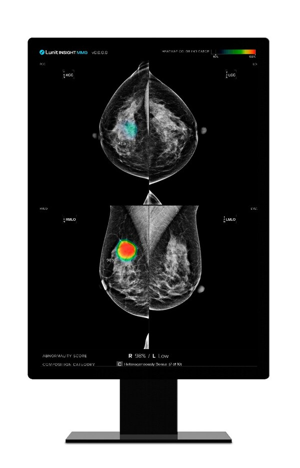 Lunit's AI-powered mammography analysis solution, Lunit INSIGHT MMG Lunit's AI-powered mammography analysis solution, Lunit INSIGHT MMG