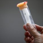 2,579 dengue cases, three deaths reported from March 24 to 30