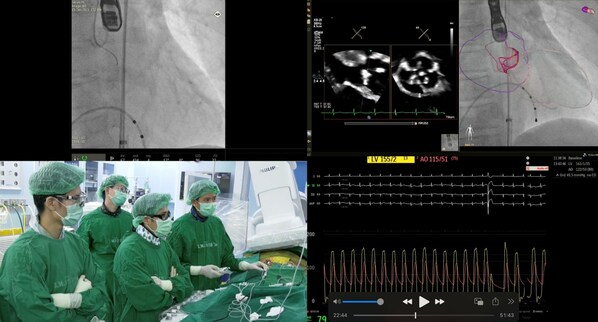 Siriraj Hospital Shines Spotlight on TAVI Procedure as Alternative for High-Risk Patients Requiring Aortic Valve Replacement