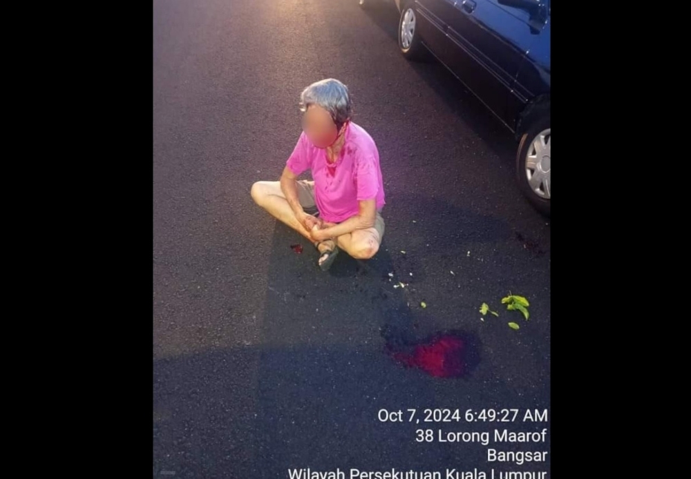 Bangsar woman left severely injured by snatch thief dies after two months, cops reviewing charges against suspect