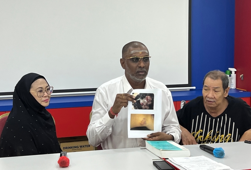 Six months on, Penang housewife seeks heavier charges after being repeatedly hit on the head with hammer by neighbour